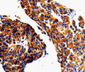 ADD1 Polyclonal Antibody – Figure 1 of 2