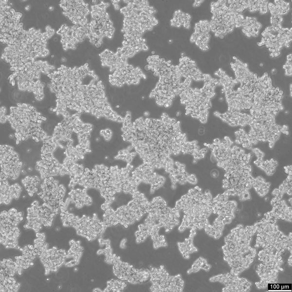 WERI-Rb-1 cell
