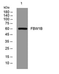FBW1B Rabbit Polyclonal Antibody – Figure 1 of 1