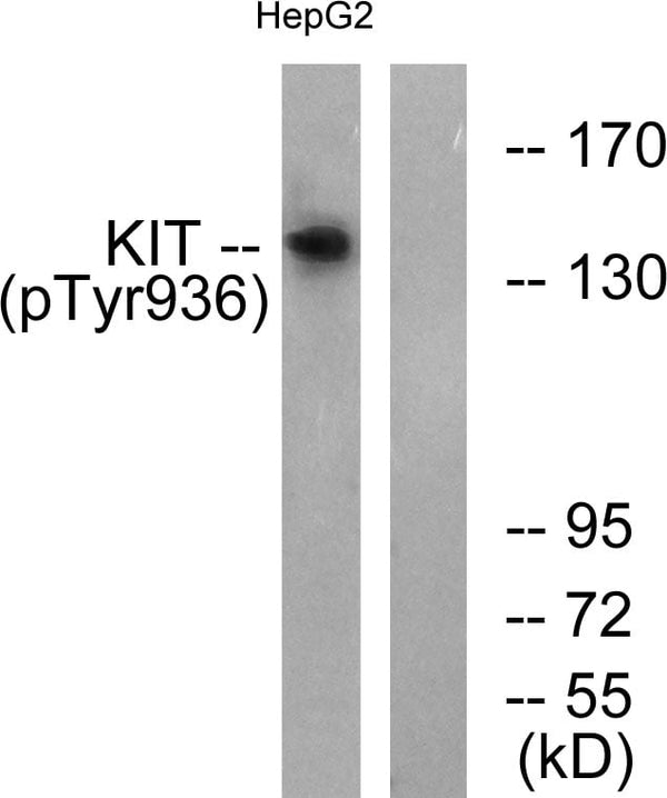 c-Kit (Phospho Tyr936) Polyclonal Antibody – Figure 1 of 3