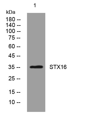 STX16 Rabbit Polyclonal Antibody – Figure 1 of 1