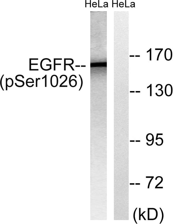EGFR(Phospho Ser1026) Polyclonal Antibody – Figure 1 of 1