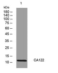 CA122 Rabbit Polyclonal Antibody – Figure 1 of 1