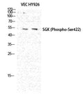 SGK1(Phospho Ser422) Polyclonal Antibody – Figure 1 of 4