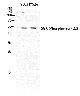 SGK1(Phospho Ser422) Polyclonal Antibody – Figure 1 of 4