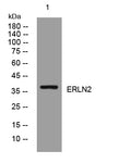 ERLN2 Rabbit Polyclonal Antibody – Figure 1 of 1