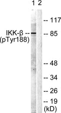 IKK beta(Phospho Tyr188) Polyclonal Antibody – Figure 1 of 3