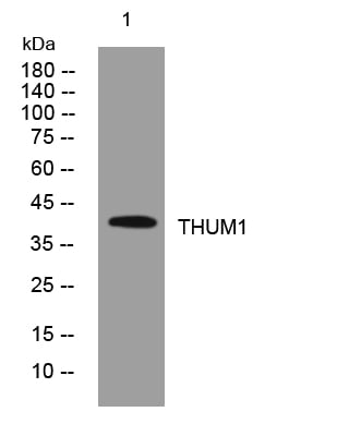 THUM1 Rabbit Polyclonal Antibody – Figure 1 of 1