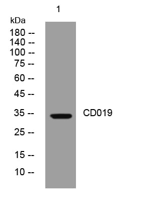 CD019 Rabbit Polyclonal Antibody – Figure 1 of 1