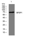 BFSP1 Rabbit Polyclonal Antibody – Figure 1 of 1