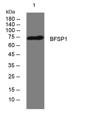 BFSP1 Rabbit Polyclonal Antibody – Figure 1 of 1