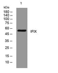 IFIX Rabbit Polyclonal Antibody – Figure 1 of 1