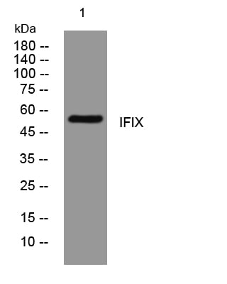 IFIX Rabbit Polyclonal Antibody – Figure 1 of 1