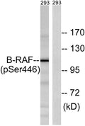 Raf-B(Phospho Ser446) Polyclonal Antibody – Figure 1 of 4