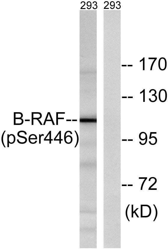 Raf-B(Phospho Ser446) Polyclonal Antibody – Figure 1 of 4