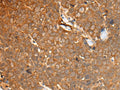 CAD Polyclonal Antibody – Figure 1 of 2