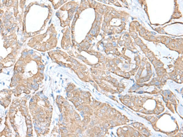 C9orf116 Polyclonal Antibody – Figure 1 of 2