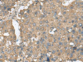 EIF4A2 Polyclonal Antibody – Figure 1 of 3