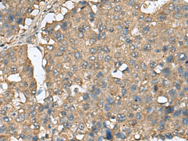 EIF4A2 Polyclonal Antibody – Figure 1 of 3