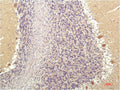 SGK1 Monoclonal Antibody – Figure 1 of 3