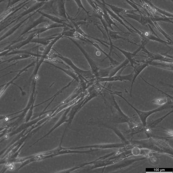 Wilms10M cell