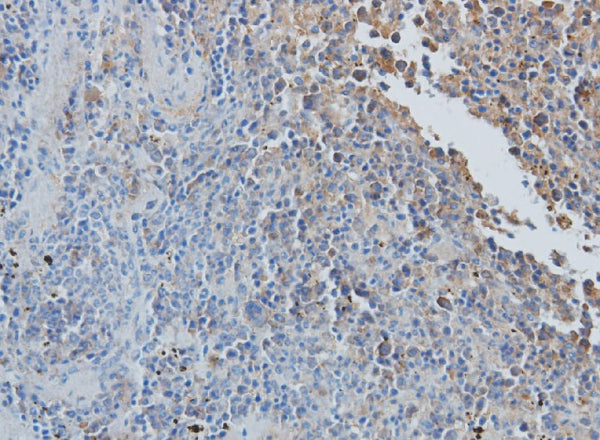 CCL7 Polyclonal Antibody – Figure 1 of 2
