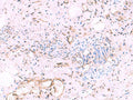 KATNAL1 Polyclonal Antibody – Figure 1 of 3