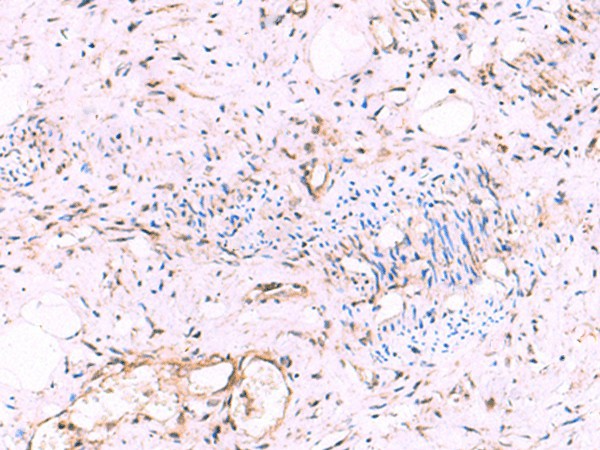 KATNAL1 Polyclonal Antibody – Figure 1 of 3