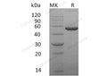 Recombinant Mouse Ephrin-A4/EFNA4 Protein (Fc Tag) – Figure 1 of 2