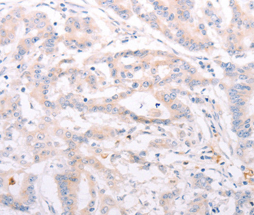 ANKRA2 Polyclonal Antibody – Figure 1 of 3