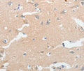 LCN2 Polyclonal Antibody – Figure 1 of 3