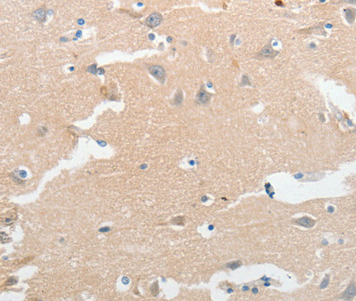 LCN2 Polyclonal Antibody – Figure 1 of 3