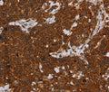 ERRFI1 Polyclonal Antibody – Figure 1 of 3