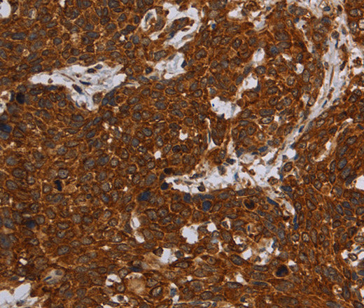 ERRFI1 Polyclonal Antibody – Figure 1 of 3