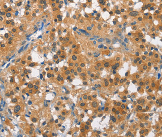 CUL7 Polyclonal Antibody – Figure 1 of 3