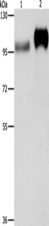 CD61 Polyclonal Antibody – Figure 1 of 4