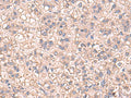 SARS Polyclonal Antibody – Figure 1 of 2