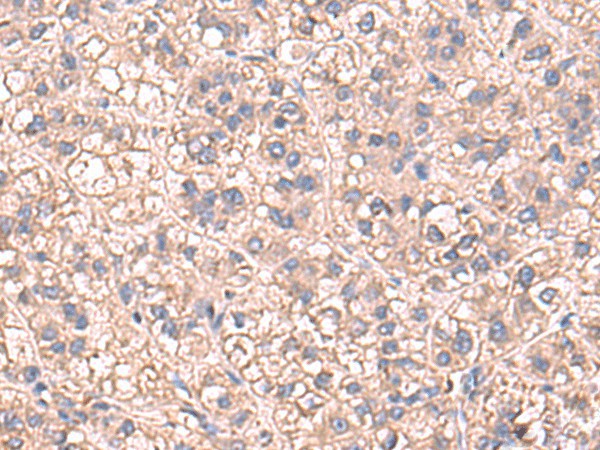 SARS Polyclonal Antibody – Figure 1 of 2