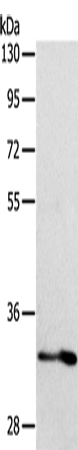 ST2 Polyclonal Antibody – Figure 1 of 4