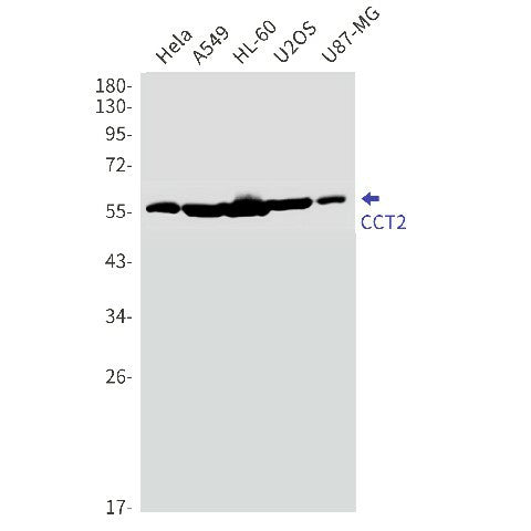 Recombinant CCT2 Monoclonal Antibody – Figure 1 of 4
