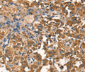 AGO1 Polyclonal Antibody – Figure 1 of 3