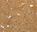AKAP12 Polyclonal Antibody – Figure 1 of 3