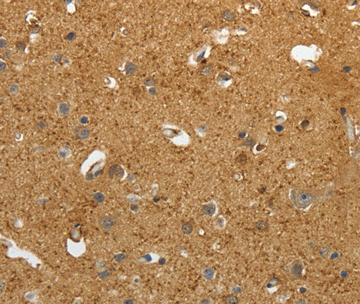 AKAP12 Polyclonal Antibody – Figure 1 of 3