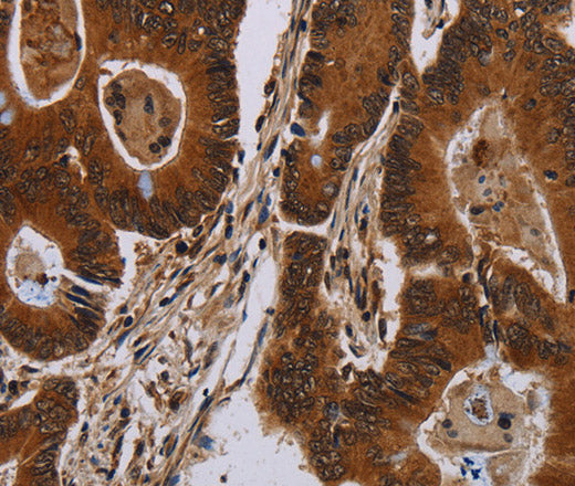 DCAF6 Polyclonal Antibody – Figure 1 of 3