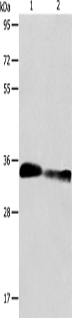 ACY3 Polyclonal Antibody – Figure 1 of 4