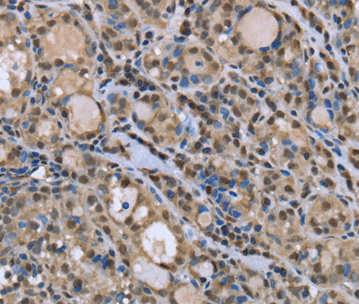DYNLL1 Polyclonal Antibody – Figure 1 of 3