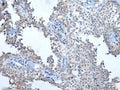 ATM Polyclonal Antibody – Figure 1 of 3