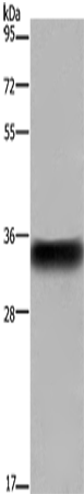 CD32 Polyclonal Antibody – Figure 1 of 4