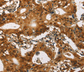Cav1.2 Polyclonal Antibody – Figure 1 of 3