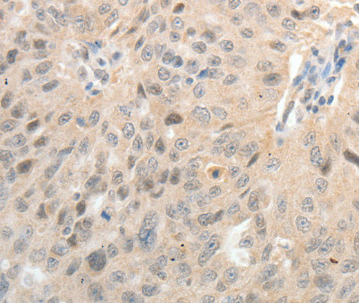 ASCL1 Polyclonal Antibody – Figure 1 of 3